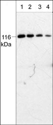 Western blot analysis of mouse brain. The blot was probed with anti-PYK2 (C-terminal region) antibody at 1:250 (lane 1), 1:500 (lane 2), 1:1000 (lane 3), and 1:2000 (lane 4).