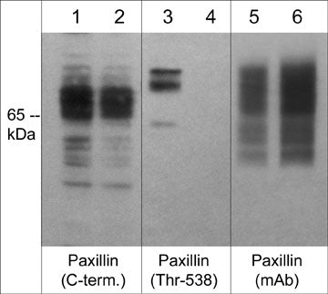 Western blot analysis of human A431 cells treated with Calyculin A (100 nm) for 30 min (lanes 1-6). The blot was treated with lambda phosphatase (lanes 2, 4, & 6), then probed with rabbit polyclonal anti-Paxillin (C-terminal; PP1161) (lanes 1 & 2), anti-phospho-Paxillin (Thr-538; PP4491) (lanes 3 & 4), and mouse monoclonal anti-Paxillin (PM1071) (lanes 5 & 6).