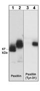 Western blot analysis of A431 cells (30 µg/lane) serum starved overnight (lane 1 & 3) or treated with pervanadate (1 mM) for 30 min (lanes 2 & 4). The blot was probed with anti-Paxillin (PM1071) or anti-phospho-Paxillin (Tyr-31) (PM1021).