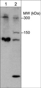 Western blot of mouse liver (lane 1) and rat PC12 cells (lane 2). The blot was probed with rabbit polyclonal Plexin B1 antibody (PP1841) at a dilution of 1:1000.