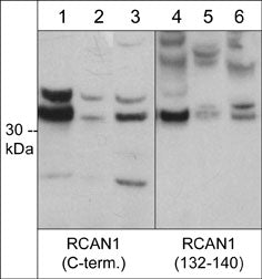 Western blot analysis of RCAN1 expression in human Jurkat (lanes 1 & 4), mouse C2C12 (lanes 2 & 5), and rat PC12 (lanes 3 & 6). The blot was probed with rabbit polyclonal anti-RCAN1 (C-terminus) at 1:1000 and anti-RCAN1 (a.a. 132-140) at 1:500.