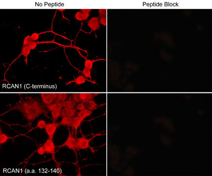 Immunocytochemical labeling of RCAN1 in aldehyde-fixed NGF-differentiated PC12 cells. The cells were labeled with rabbit polyclonal anti-RCAN1 (C-terminus) (RP3941) and anti-RCAN1 (a.a. 132-140) (RP3961) antibodies (Left side). These antibodies were also used in the presence (Right side) of blocking peptide RX3945 and RX3965, respectively. The antibodies were detected using appropriate secondary antibody conjugated to DyLight® 594.