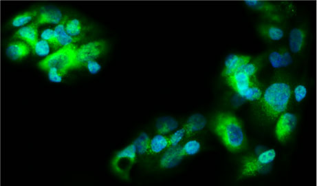 Immunofluorescent staining of HepG2 cells using 10 ug/mL rabbit polyclonal anti-Ferritin antibody (RP-4001) (green). The cells were mounted with Antibodies Incorporated Fluoroshield with DAPI mounting medium (Cat