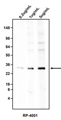 Western blotting of HepG2 cell lysate using 0.2 ug/mL, 1 ug/mL, or 5 ug/mL  Antibodies Incorporated rabbit anti-Ferritin heavy chain antibody (RP-4001). RP-4011 rabbit anti-Ferritin antibody recognizes endogenous Ferritin heavy chain at ~25 kDa.
