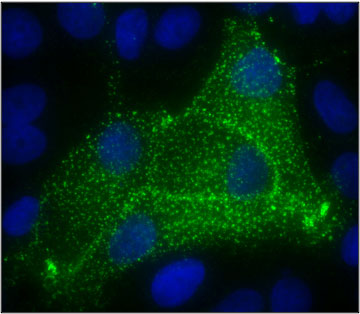 Immunofluorescent staining of MCF7 cells using 5 ug/mL rabbit polyclonal anti-Carcinoembryonic antigen (CEA) antibody (RP-4005) (green). The cells were mounted with Antibodies Incorporated Fluoroshield with DAPI mounting medium (Cat