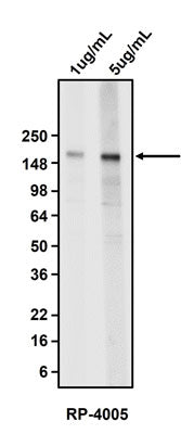 Western blotting of MCF7 cell lysate using 1 ug/mL and 5 ug/mL rabbit polyclonal anti-Carcinoembryonic antigen (CEA) antibody (RP-4005). RP-4005 rabbit anti-Carcinoembryonic antigen antibody recognizes endogenous CEA at 180 kDa.