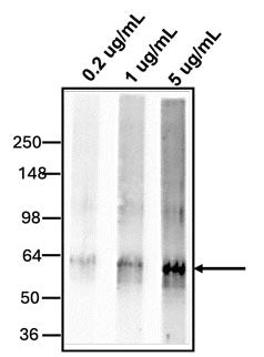 Western blotting of HeLa Cell lysate using 0.2 ug/mL,  1 ug/mL, or 5 ug/mL rabbit polyclonal anti-MUC2 antibody (RP-4013). RP-4013 rabbit anti-MUC2 antibody recognizes endogenous Mucin 2 at ~ 64 kDa (Tris- Glycine).