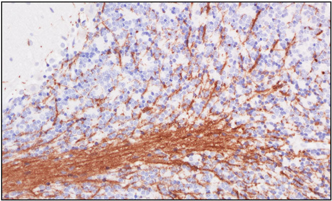 Representative sections of formalin fixed, paraffin-embedded rat brain showing staining of Myelin Basic Protein (MBP). The sections were stained with rabbit polyclonal anti-MBP antibody at 1:1000 dilution and detected with anti-mouse HRP.