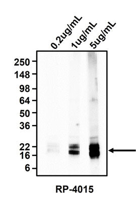 Western blotting of rat brain homogenates using  0.2 ug/mL, 1 ug/mL, or 5 ug/mL rabbit polyclonal anti-Myelin Basic Protein (MBP) (RP-4015). RP-4015 rabbit anti-MBP recognizes endogenous MBP at 20 kDa.