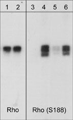 Western blot analysis of human RhoA GST fusion recombinant unphosphorylated (lanes 1 & 3) or phosphorylated with PKA (lanes 2, 4, 5 & 6). The blots were probed with anti-Rho (RP1501; lanes 1 & 2) or with anti-RhoA (Ser-188) (RP1361; lanes 3-6). The latter antibody was used in the presence of no peptide (lanes 3 & 4), phospho-Rho (Ser-188) peptide (lane 5), or a non-specific phosphoserine peptide (lane 6).