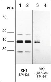 Western blot of HeLa stimulated with calyculin A (lanes 1-4). The blots were untreated (lane 1 & 3) or treated with lambda phosphatase (lane 2 & 4), then probed with anti-SK1 (Central region) SP1621 (lanes 1 & 2) or anti-SK1 (Ser-225) SP1641 (lanes 3 & 4).