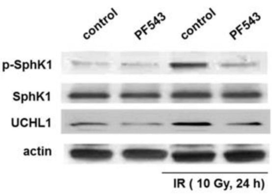 In separate experiments, human pulmonary artery ECs were treated with a pharmacologic SphK1 inhibitor, PF-543 (10 µM), 1 h prior to irradiation, followed by Western blotting for p-SphK1 (cat. SP1641), SphK1, and UCHL1. Representative blots are shown. Image from publication CC-BY-4.0. PMID: 37830619