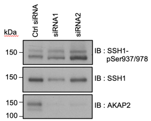 DU-145 cells were transfected with control (Ctrl siRNAs) or AKAP2 specific siRNAs (siRNA1 and siRNA2). 72 h after transfection, cell lysates were loaded on SDS-PAGE gels and analyzed by Western blot. Phospho-SSH1 was detected using antibodies recognizing phospho-serines 937 and 978 (cat. SP3901). The amounts of SSH1 (cat. SP1711) and AKAP2 were detected using specific antibodies, as indicated. Image from publication CC-BY-4.0. PMID: 37827203