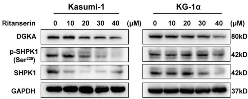 The protein expression levels of DGKα, SphK1 (cat. SP5421, 1:1000) and p-SphK1(Ser225) (cat. SP1641) in AML cells after ritanserin treatment for 48 h. Image from publication CC-BY-4.0. PMID: 37392305