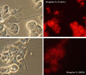 Immunocytochemical labeling of Slingshot-1L in rat PC12 cells differentiated with NGF. The cells were labeled with rabbit polyclonal anti-SSH1L (C-term.) and anti-SSH1L (Ser-978) antibodies, then detected using appropriate secondary antibody conjugated to Cy3 (Right panel). Phase image of corresponding PC12 cells (Left panel).