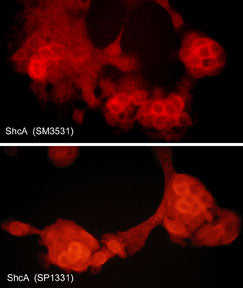 Immunocytochemical labeling of ShcA in paraformaldehyde-fixed and NP-40-permeabilized A431 cells. The cells were labeled with mouse monoclonal (top) and rabbit polyclonal (bottom) ShcA antibodies, then the antibodies were detected using appropriate secondary antibodies conjugated to Cy3.