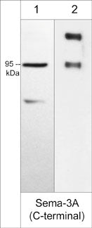 Western blot image of human A431 cells and (lane 1) and human recombinant Sema3A/Fc chimera (95/125 kDa) (lane 2). The blots were probed with rabbit polyclonal anti-Semaphorin 3A (SP1241) at a dilution of 1:1000.