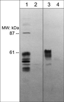 Western blot analysis of rat PC12 cells (lanes 1 & 2) and human PC-3 cells (lanes 3 & 4). The blots were probed with anti-Sema-3E (N-terminal region) antibody in absence (lanes 1 & 3) or presence of Sema-3E (N-terminal region) blocking peptide (lanes 2 & 4).