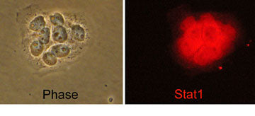 Immunocytochemical labeling of Stat1 in human A431 cells. The cells were labeled with mouse monoclonal Stat1 (SM2491) antibody (Right), then the antibody was detected using appropriate secondary antibody conjugated to DyLight® 594. Corresponding phase image is shown to the left.