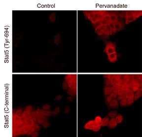 Immunocytochemical labeling of Stat5 in control and pervanadate-treated A431 cells. The cells were labeled with mouse monoclonal Stat5 (SM2511) or Stat5 (Tyr-694) (SM1481) antibodies, then the antibodies were detected using appropriate secondary antibody conjugated to DyLight® 594.