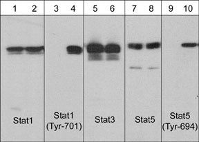 Western blot analysis of human A431 cells untreated (lanes 1, 3, 5, 7, & 9) or treated with EGF (100 ng/ml for 60 min (lanes 2, 4, 6, 8, & 10). The blots were probed with anti-Stat1 (lanes 1 & 2), anti-Stat1 (Tyr-701) (lanes 3 & 4), anti-Stat3 (lanes 5 & 6), anti-Stat5 (lanes 7 & 8), and anti-Stat5 (Tyr-694) (lanes 9 & 10).