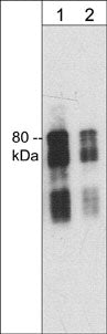 Western blot of mouse brain lysate. The blot was probed with mouse monoclonal anti-Synapsin I (C-terminal region) antibody at 1:250 (lane 1) or 1:1000 (lane 2).