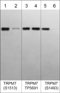 Anti-TRPM7 (Ser-1513), Phosphospecific Antibody