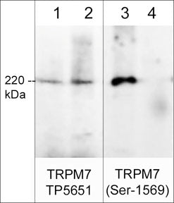 Western blot image of rat PC12 cells (lanes 1-4). The blot was treated with lambda phosphatase to dephosphorylate TRPM7 (lanes 2 & 4). The blot was probed with rabbit polyclonals anti-TRPM7 (Extracellular region) TP5651 (lanes 1 & 2) or anti-TRPM7 (Ser-1569) phospho-specific (lanes 3 & 4).