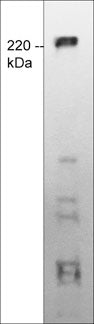 Western blot image of TRPM7 expression in human MCF-7 cell lysate. The blot was probed with mouse monoclonal anti-TRPM7 (Extracellular region) M573 at a dilution of 1:250.