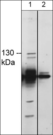 Western blot image of human TRPM8 in human MDA-MB-231 cells. The blot was probed with rabbit polyclonal anti-TRPM8 (extracellular region) without peptide blocking (lane 1) or with peptide blocking (lane 2).