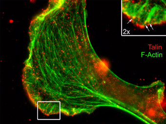 Immunocytochemical labeling of Talin relative to F-actin in chick fibroblasts. The cells were labeled with mouse monoclonal Talin (Rod domain) antibody (TM4081), then the antibody was detected using appropriate secondary antibody (Red). This labeling is compared to F-actin staining (Green). (Image provided by Dr. Gianluca Gallo at Drexel University).