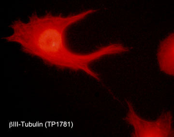 Immunocytochemical labeling of β-tubulin in aldehyde fixed and NP-40 permeabilized human NCI-H1299 lung carcinoma cells. The cells were labeled with rabbit polyclonal anti-β-Tubulin (TP1781). The antibody was detected using goat anti-rabbit DyLight® 594.