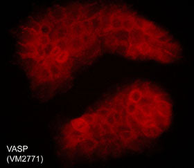 Immunocytochemical labeling of VASP in aldehyde-fixed and NP-40-permeabilized A431 cells. The cells were labeled with mouse monoclonal VASP (C-terminal region) antibody, then the antibody was detected using appropriate secondary antibody conjugated to DyLight® 594.