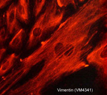 Immunocytochemical labeling of Vimentin in paraformaldehyde fixed and NP-40 permeabilized A7r5 cells. The cells were labeled with a mouse monoclonal antibody to Vimentin (VM4341), then the antibody was detected using Goat anti-Mouse secondary antibody conjugated to DyLight® 594.