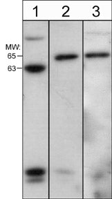 Western blot analysis of Jurkat (lane 1), A431 (lane 2), and HeLa (lane 3) cell lysates (20 µg/lane). Blots were probed with rabbit polyclonal anti-WASP/N-WASP (WP2101).