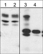 Western blot of human K562 cells treated with pervanadate (1 mM, 30 min) (lanes 1 & 3) then treated with alkaline phosphatase (lanes 2 & 4). The blots were probed with anti-WAVE2 (Central region) (lanes 1 & 2) or anti-WAVE (Tyr-150) (lanes 3 & 4).