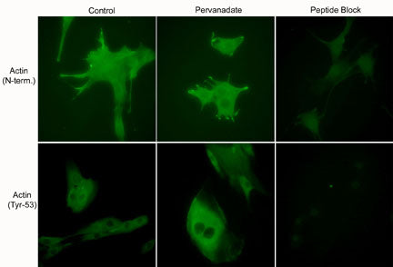 Immunocytochemical labeling using anti-Actin (N-terminal) and anti-Actin (Tyr-53) polyclonal antibodies in C2C12 cells control (left) or treated with pervanadate (1 mM) for 30 min (middle). The cells were fixed in paraformaldehyde and permeabilized in acetone. Both antibodies were used in the presence of blocking peptide: Actin (N-terminal) peptide (AX1655) or phospho-Actin (Tyr-53) peptide (AX1675), respectively (right).