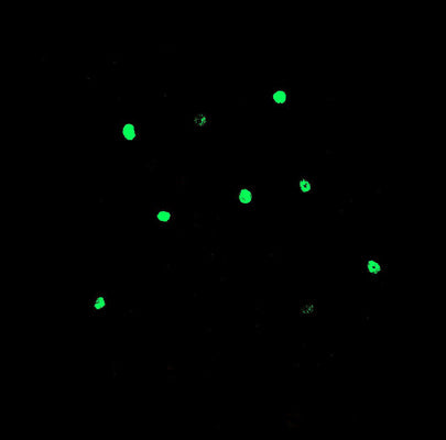 Basolateral amygdala from c-fos-lacZ transgenic male rats labeling LacZ (Cat no BGal, 1:1000, green). The image was kindly provided by Benedetto Sacchetti, Università di Torino.