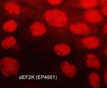 Immunocytochemical labeling of eEF2K in paraformaldehyde fixed and NP-40 permeabilized A431 cells. The cells were labeled with rabbit polyclonal anti-eEF2K (EP4661). The antibody was detected using goat anti-rabbit DyLight® 594.