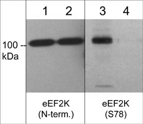 Western blot image of C2C12 treated with calyculin A (100 nM) for 30 min. (lanes 1 & 3), then the blot was treated with lambda phosphatase (lanes 2 & 4). The blot was probed with anti-eEF2K (N-terminus) at 1:500 (lanes 1 & 2) and anti-eEF2K (Ser-78) (EP4391) at 1:1000.