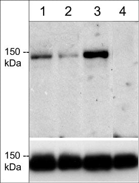 Western blot analysis of COS-7 cells expressing flag-tagged mDia2 (lanes 1-3) or mDia2 mutant (T1061A) (lane 4). The cells were untreated (lane 1) or treated with calyculin A (lanes 2 & 3). The blot was treated with alkaline phosphatase (lane 2), then probed with anti-mDia2 (Thr-1061) (upper blot) or anti-flag antibody (lower blot). (Image provided by Dr. Christopher Mack in the Dept. of Pathology at UNC Chapel Hill).