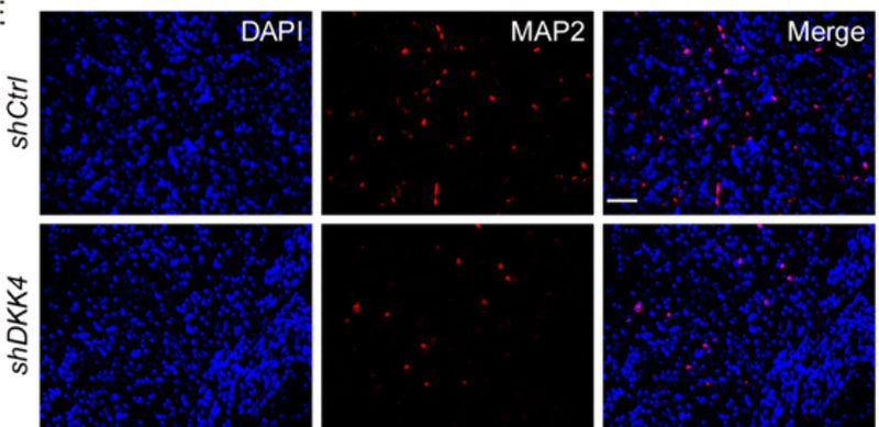 Representative images (E) and quantification (F) of MAP2 (cat MAP, red) immunofluorescence staining in xenografts dissected from nude mice harbouring 3117-shCtrl or 3117-shDKK4 intraperitoneally. Image from publication CC-BY-4.0. PMID:38519641