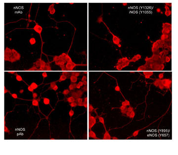 Immunocytochemical labeling of nNOS phosphorylation in rat PC12 cells differentiated with NGF. The cells were probed with mouse monoclonal (mAb) nNOS (NM4011), and rabbit polyclonal (pAb) nNOS (C-terminal region), nNOS (Tyr-895)/eNOS (Tyr-657), and nNOS (Tyr-1326)/iNOS (Tyr-1055). The antibodies were detected using appropriate secondary antibody conjugated to DyLight® 594.