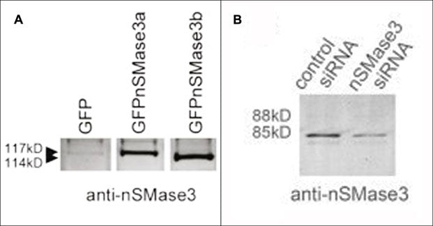 Western blot of nSMase3a and nSMase3b GFP transfectants (A) and nSMase3 siRNA knockdown in C2C12 myotubes (B). Both blots were probed with anti-nSMase3 (C-terminal region) rabbit polyclonal antibody (SP0281). (Image provided by Dr. Jennifer Moylan, Dept. Physiology, University of Kentucky).