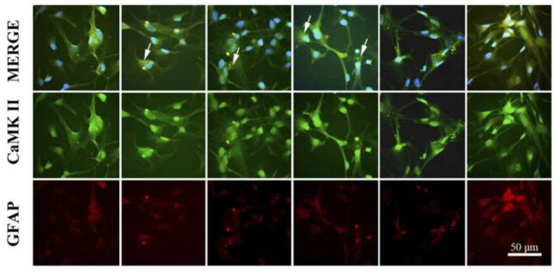 Astrocytes (1 × 106 cells/ml) were cultured for 24 h without treatment or with METH (10 μM), clade B gp120 (50 ng/ ml), or clade C gp120 (50 ng/ ml) alone or METH in combination with clade B or C gp120. After incubation, the cells were fixed, permeabilized, and stained for (A) DRD-2, (B) phospho-CaMK II (cat. p1005-286) (C) phospho-CaMK IV (green) or GFPA (red) and DAPI (blue). The cells were imaged using a confocal microscope at 630x and analyzed using immunocytochemistry. Image from publication CC-BY-4.0.