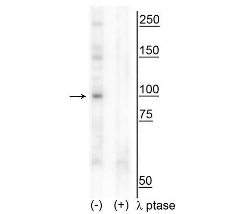 Western blot of human T47D cell lysate showing specific immunolabeling of the ~100 kDa CtIP phosphorylated at Thr847 in the first lane (-). Phosphospecificity is shown in the second lane (+) where immunolabeling is completely eliminated by blot treatment with lambda phosphatase (λ-Ptase, 1200 units for 30 min).