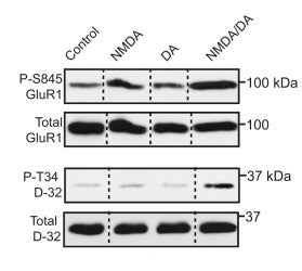 Effects of striatal slice treatment with NMDA (25 μM, 5 min), dopamine (DA, 10 μM, 15 min), or both on PKA-dependent phosphorylation of Ser845 GluR1 (top) and Thr34 DARPP-32 (bottom). Image from publication CC-BY-4.0. PMID: 35835216