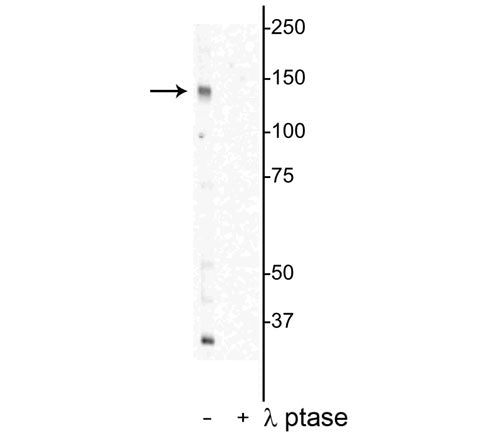 Western blot of HeLa cell lysate showing specific immunolabeling of the ~142 kDa DENND3 protein phosphorylated at Thr450 in the first lane (-). Phosphospecificity is shown in the second lane (+) where immunolabeling is completely eliminated by lysate treatment with lambda phosphatase (λ-Ptase, 800 units/1mg protein for 30 min).