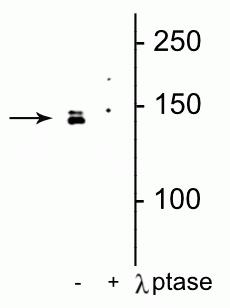 Western blot of HeLa cell lysate showing specific immunolabeling of the ~142 kDa DENND3 protein phosphorylated at Ser554 in the first lane (-). Phosphospecificity is shown in the second lane (+) where immunolabeling is completely eliminated by lysate treatment with lambda phosphatase (λ-Ptase, 800 units/1mg protein for 30 min). 