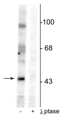 Western blot of rat testes lysate showing specific immunolabeling of the ~46 kDa EphrinB phosphorylated at Tyr331 in the first lane (-). Phosphospecificity is shown in the second lane (+) where immunolabeling is completely eliminated by lysate treatment with lambda phosphatase (λ-Ptase, 800 units/1 mg protein for 30 min). 